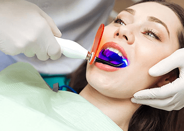 Diş Beyazlatma